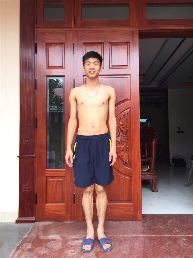 Lê Tiến Bình lúc gầy, thiếu sức sống